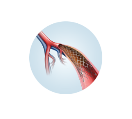 Stent periferico autoexpandible